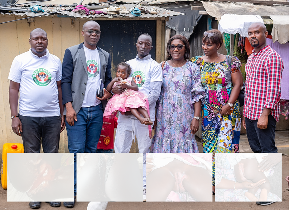 Cas de brûlure physique (agression) : enfant D.