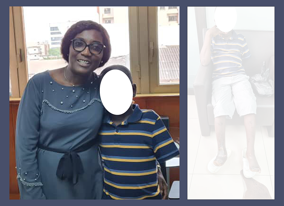 Cas de brûlure par électricité : cas H. E.